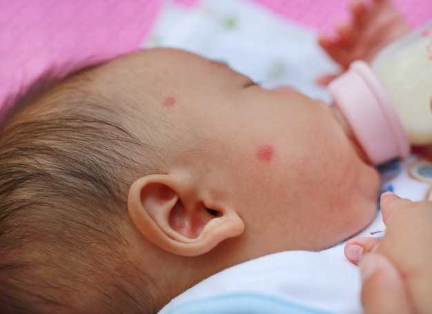 Контактный дерматит у детей: особенности и подходы к лечению