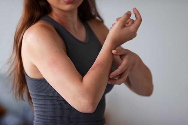 Характерные признаки аллергии на руке