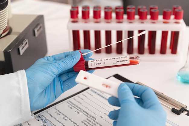 Процесс подготовки к общему анализу крови