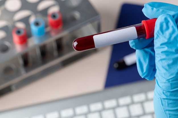 Какие показатели крови изменяются при ВИЧ?